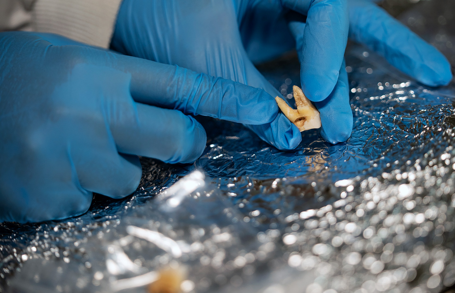 Gloved hands examining a tooth for DNA analysis